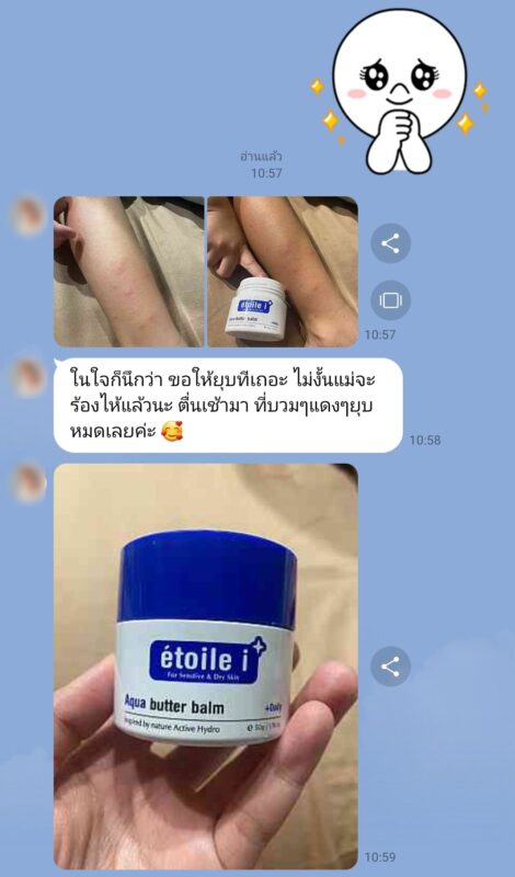 รีวิวบัตเตอร์บาล์ม